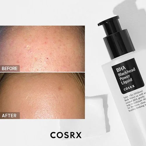 COSRX Bha Blackhead Power Liquid, 100ml - Esfoliante chimico