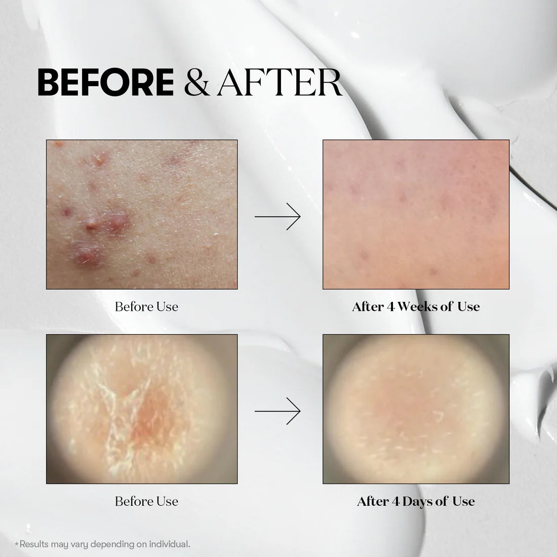 vt cosmetics reedle shot effetto