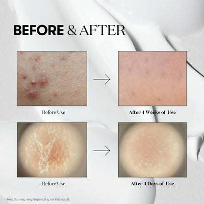 vt cosmetics reedle shot effetto